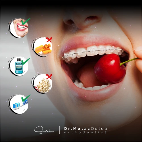 care for your Teeth During and After the Orthodontic